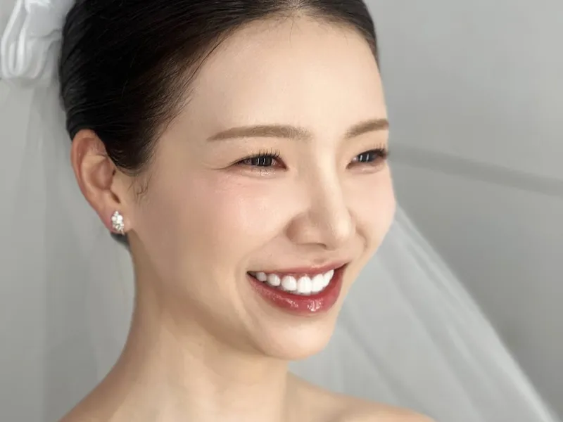 이수라인 사진 2