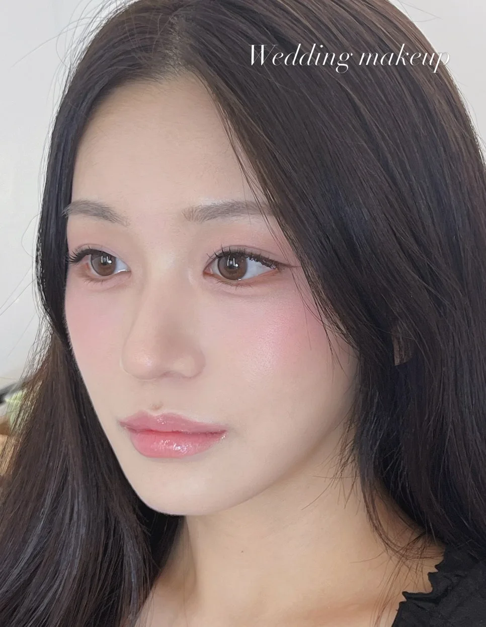 이수라인 사진 3